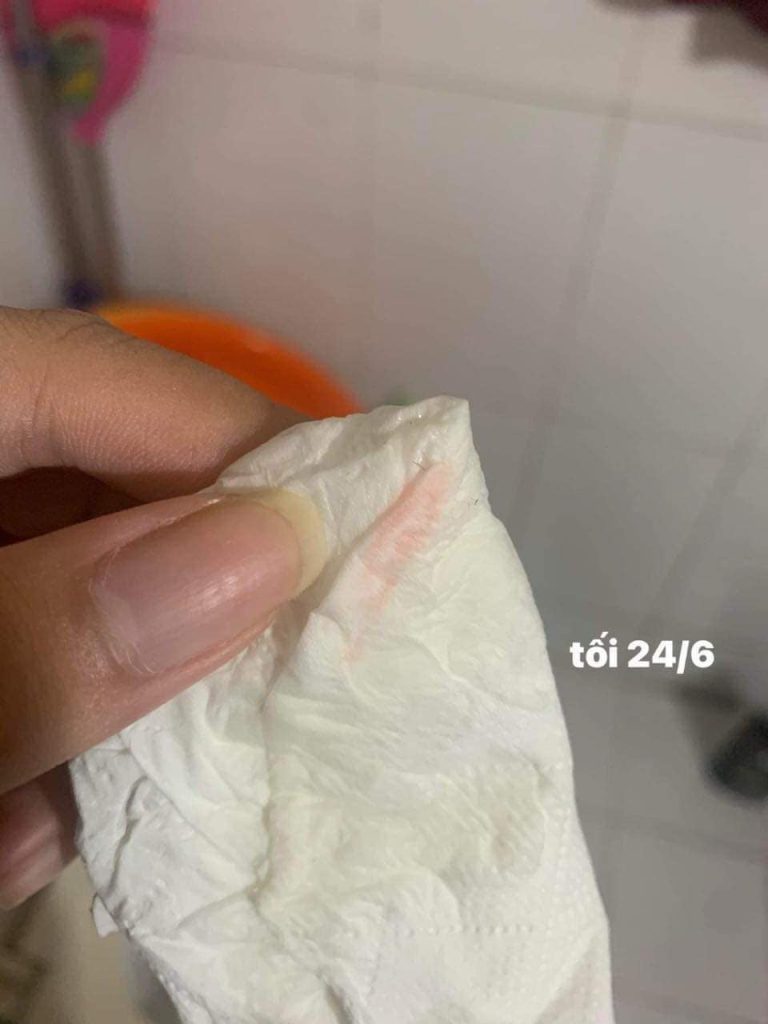 Hình ảnh do khách hàng Tuyết Mai cung cấp