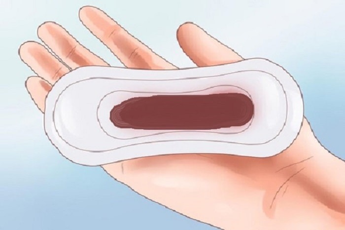 khí hư màu nâu loãng