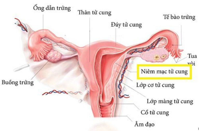 niêm mạc tử cung