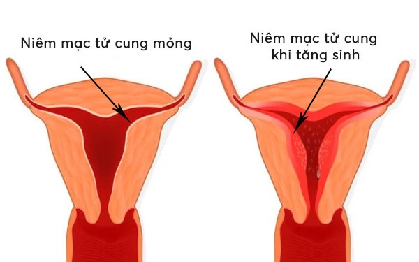 niêm mạc
