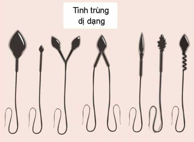 tinh trùng