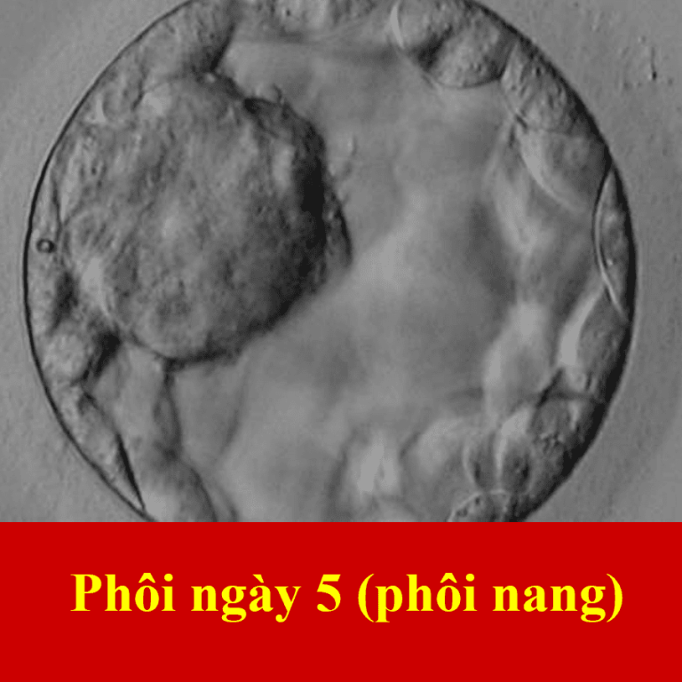 phôi ngày 5