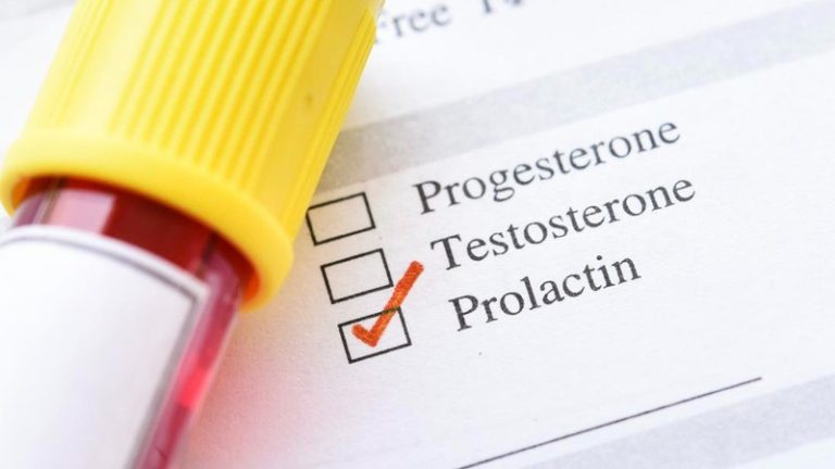 prolactin