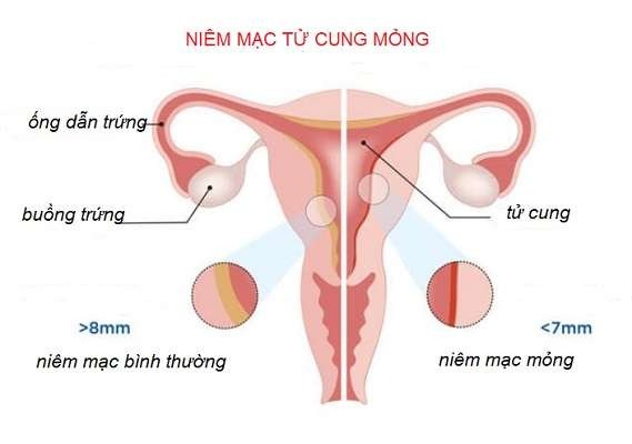 niêm mạc