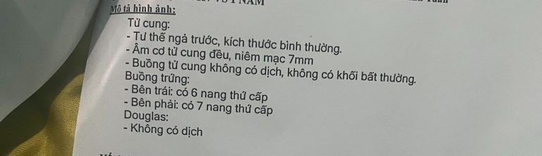 buồng trứng