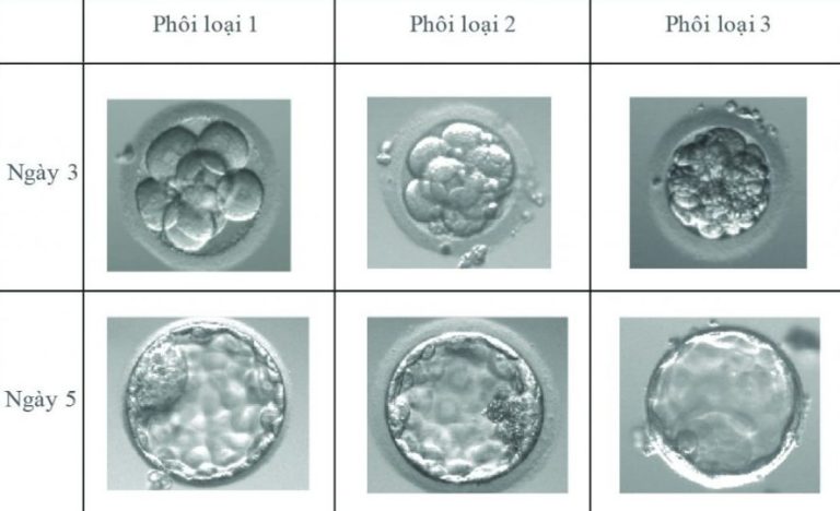 phôi n3l1