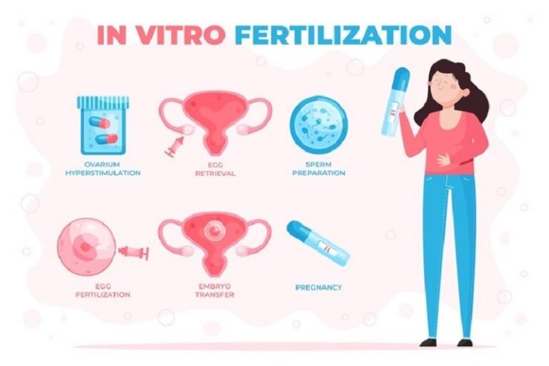 IVF