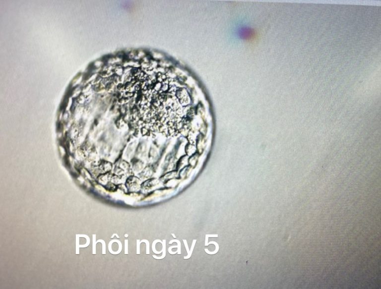 chuyển phôi