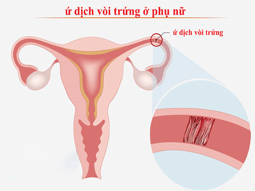 vòi trứng