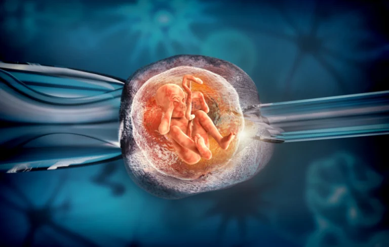 IVF