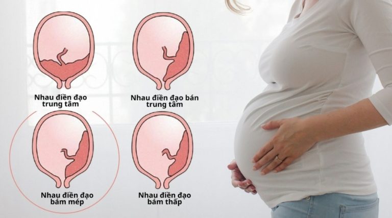 Rau tiền đạo
