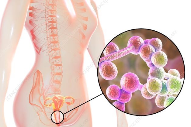 điều trị nấm candida