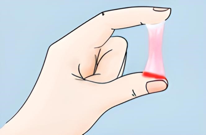 dịch nhầy trong suốt có lẫn máu