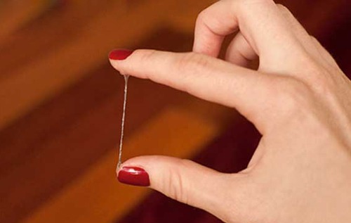 khí hư ra nhiều