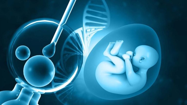 IVF