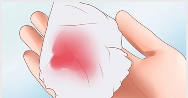 âm đạo chảy máu