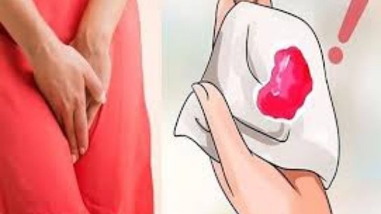 chảy máu vùng kín