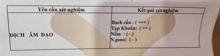 chất nhầy hơi vàng