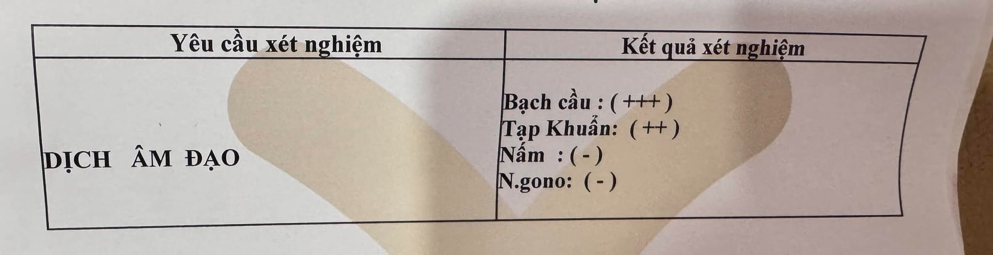 Vừa hết ngày kinh, thì ra máu tiết có đông cục dính chất nhầy hơi vàng có sao không? 2 chất nhầy hơi vàng
