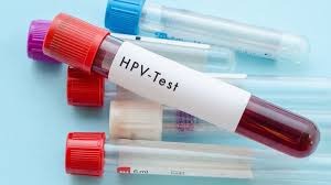 Dương tính với HPV