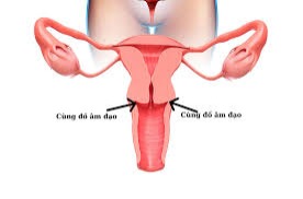 cô bé có vết thương