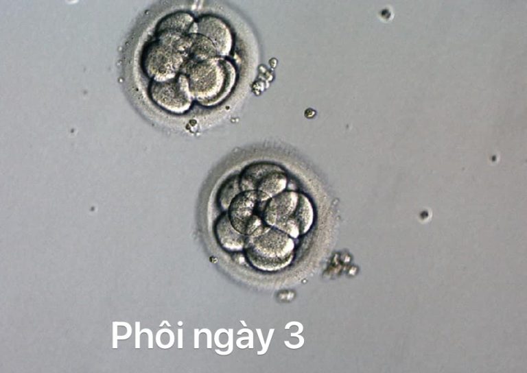 phôi loại 3