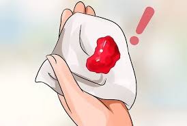 ra máu âm đạo