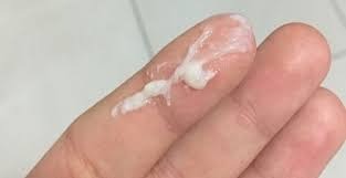 khí hư màu trắng đục