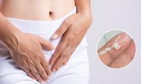 nhiều dịch đục
