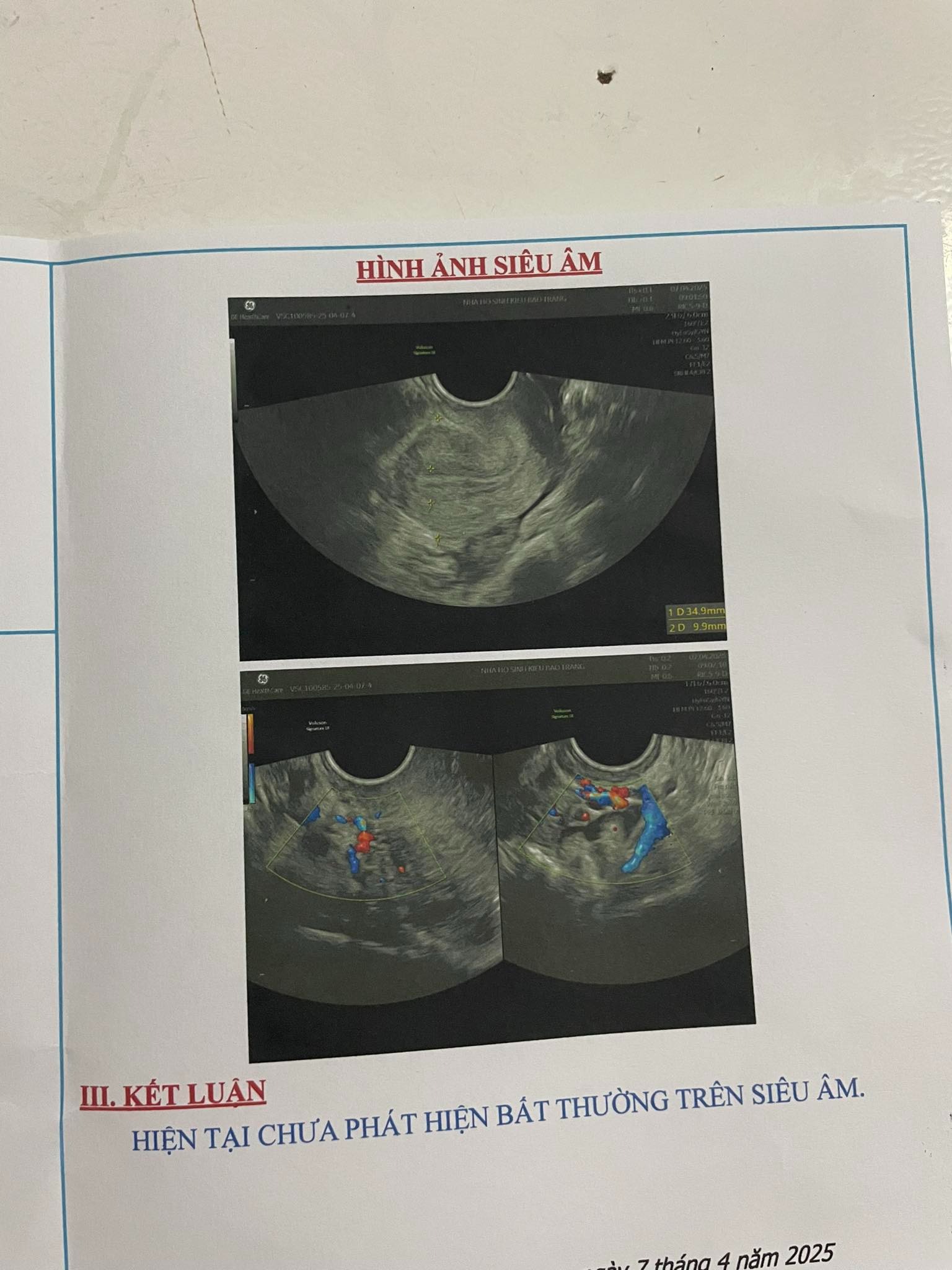 Đi khám phụ khoa thấy hình siêu âm giống buồng trứng đa nang nhưng không thấy bác sĩ nhắc đến là tại sao? 2 Hình ảnh do khách hàng ẩn danh cung cấp