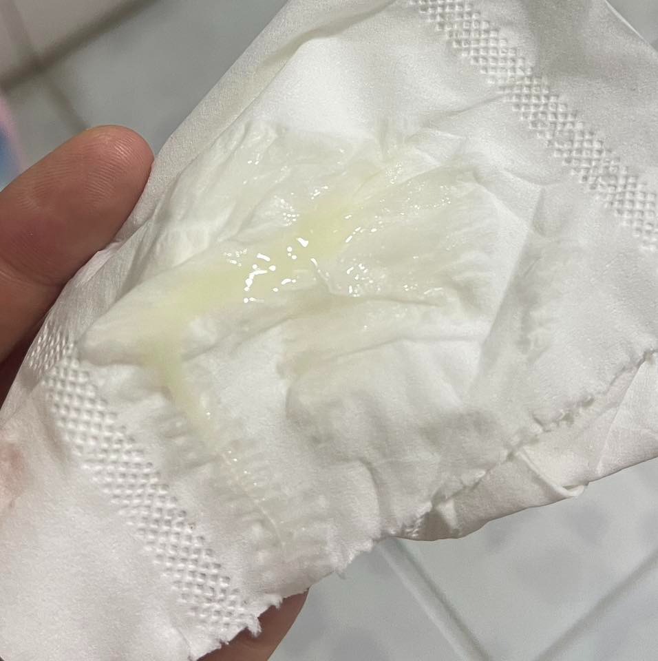 Ra dịch nhầy, dai trong kì rụng trứng có sao không? 2 Hình ảnh do khách hàng ẩn danh cung cấp