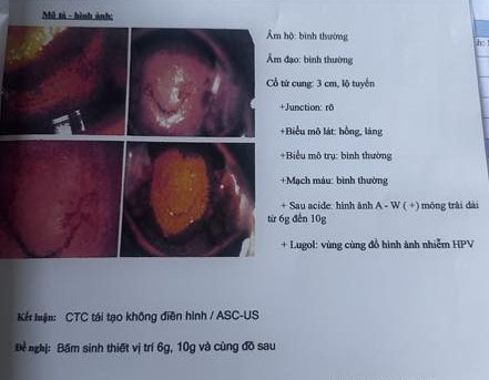 Âm tính HPV, bấm sinh thiết kết quả LSIL/CIN 1 có thể dùng thêm Gel Paplicocare được không? 4 Hình ảnh do khách hàng ẩn danh cung cấp