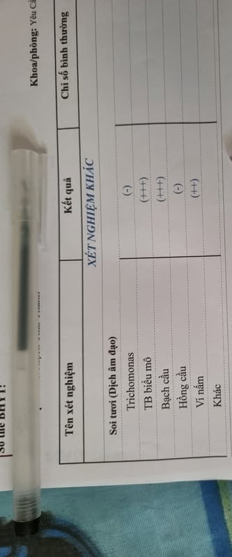 Soi tươi có kết quả dương tính là bị bệnh gì? 2 682bf54b698ea soi tuoi 1
