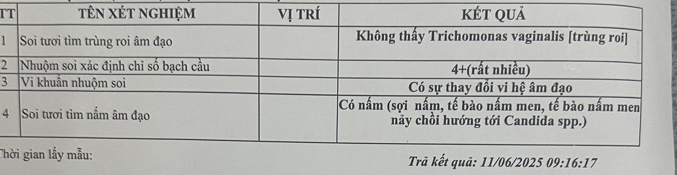 Viêm âm đạo do nấm bác sĩ chưa cho thuốc nên làm gì? 2 Hình ảnh do khách hàng ẩn danh cũng cấp
