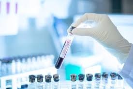 xét nghiệm tiền hôn nhân