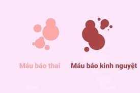 máu báo thai