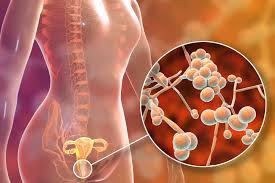 nấm Candida