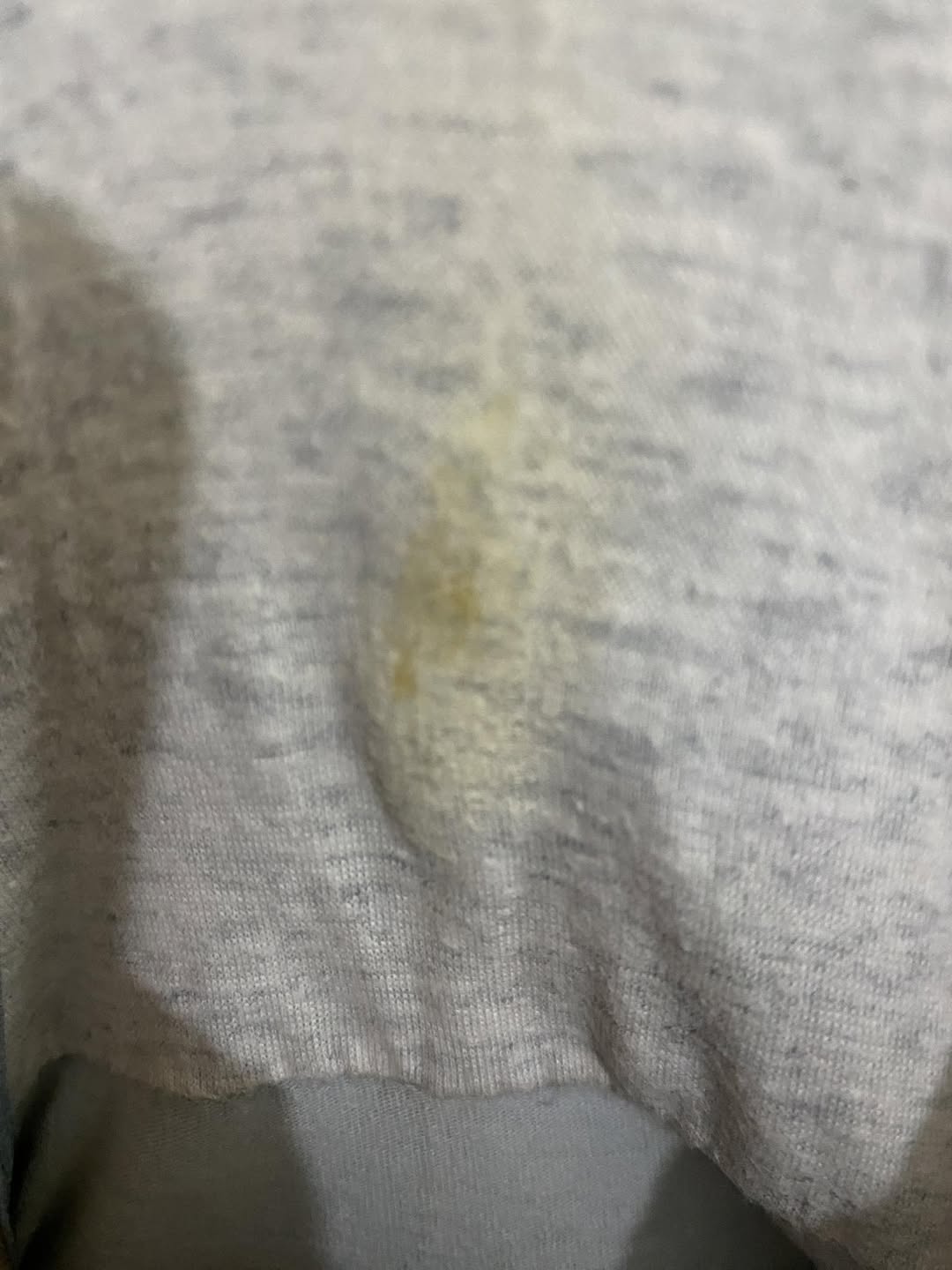 Quần lót hay bị vàng, khô cứng là dấu hiệu bệnh gì? 2 589622454 1499657517932195 6476340255812693678 n