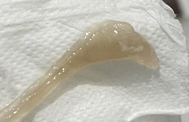 Dịch âm đạo ra như vậy có còn là bình thường không? 2 590642774 1522822992269544 4887761145098451850 n