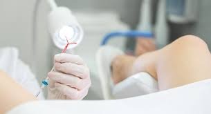 tháo vòng tránh thai