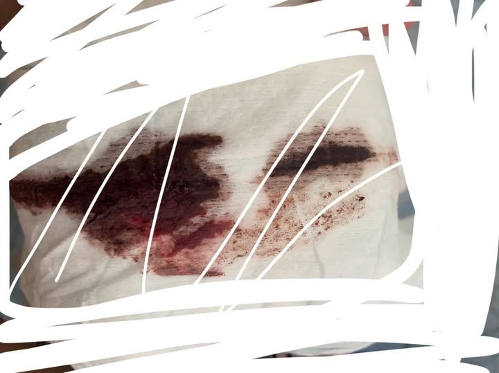 Hình ảnh minh họa do khách hàng cung cấp