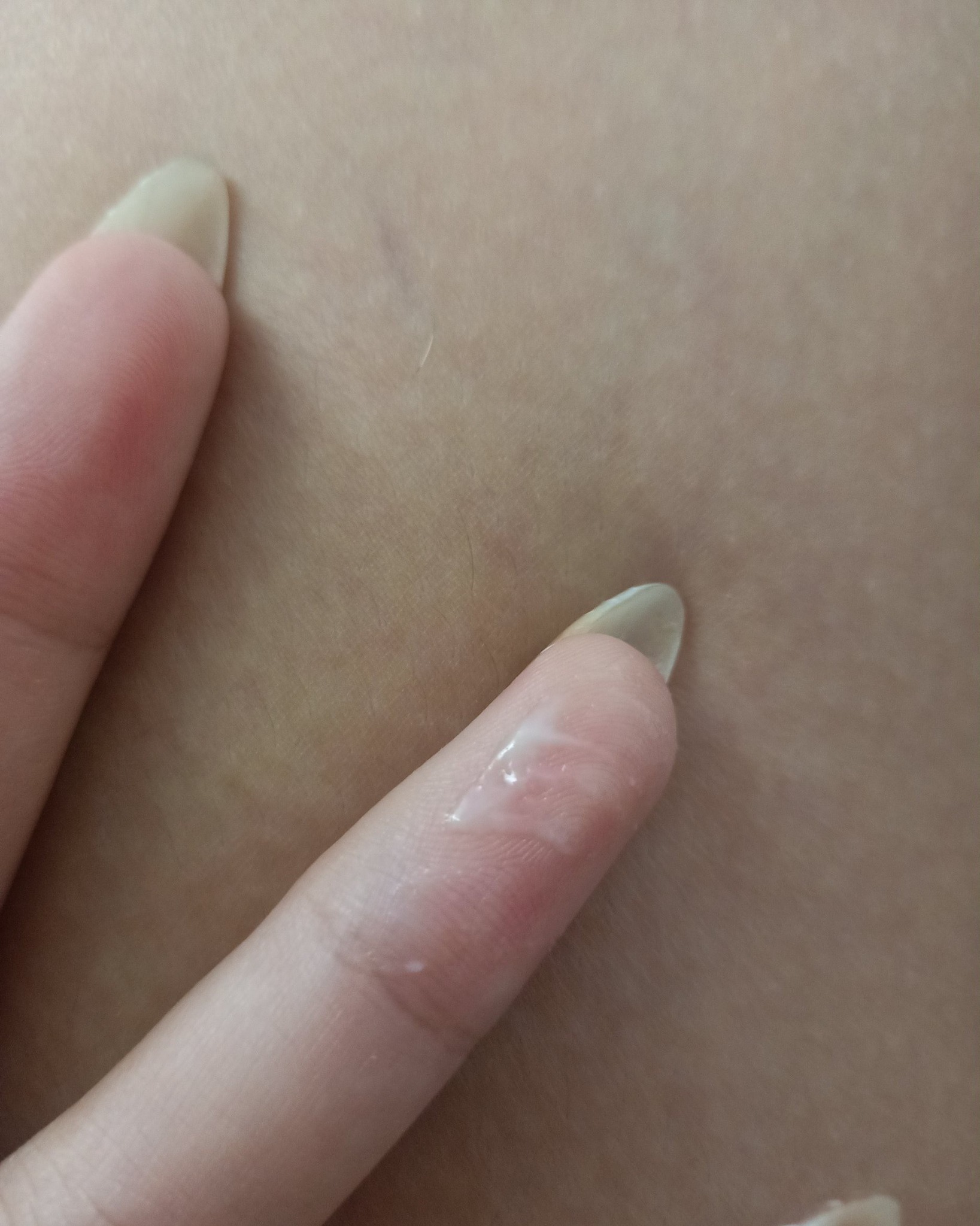 Ra khí hư trong suốt, không mùi trước kỳ kinh có phải bị nấm không? 2 68db55544a1cf khi hu