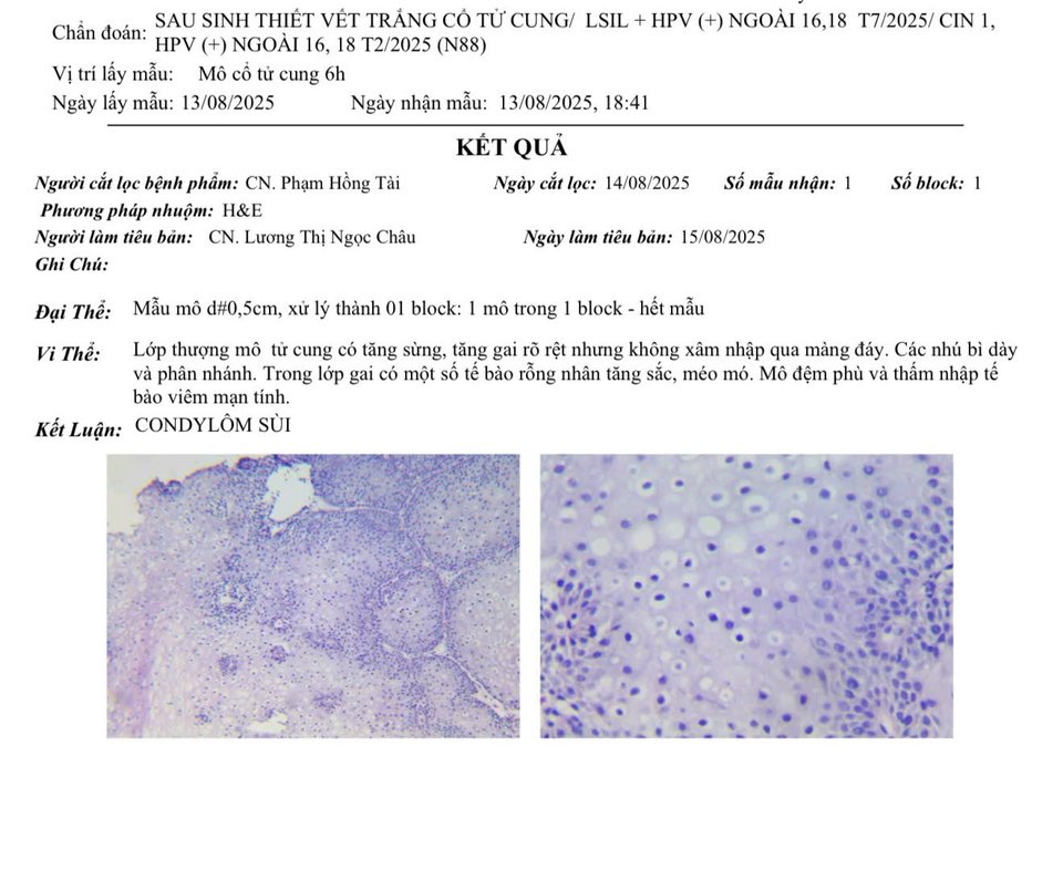 CIN 1 sinh thiết lại ra sùi có phải đã hết chưa? 2 Hình ảnh do khách hàng ẩn danh cung cấp