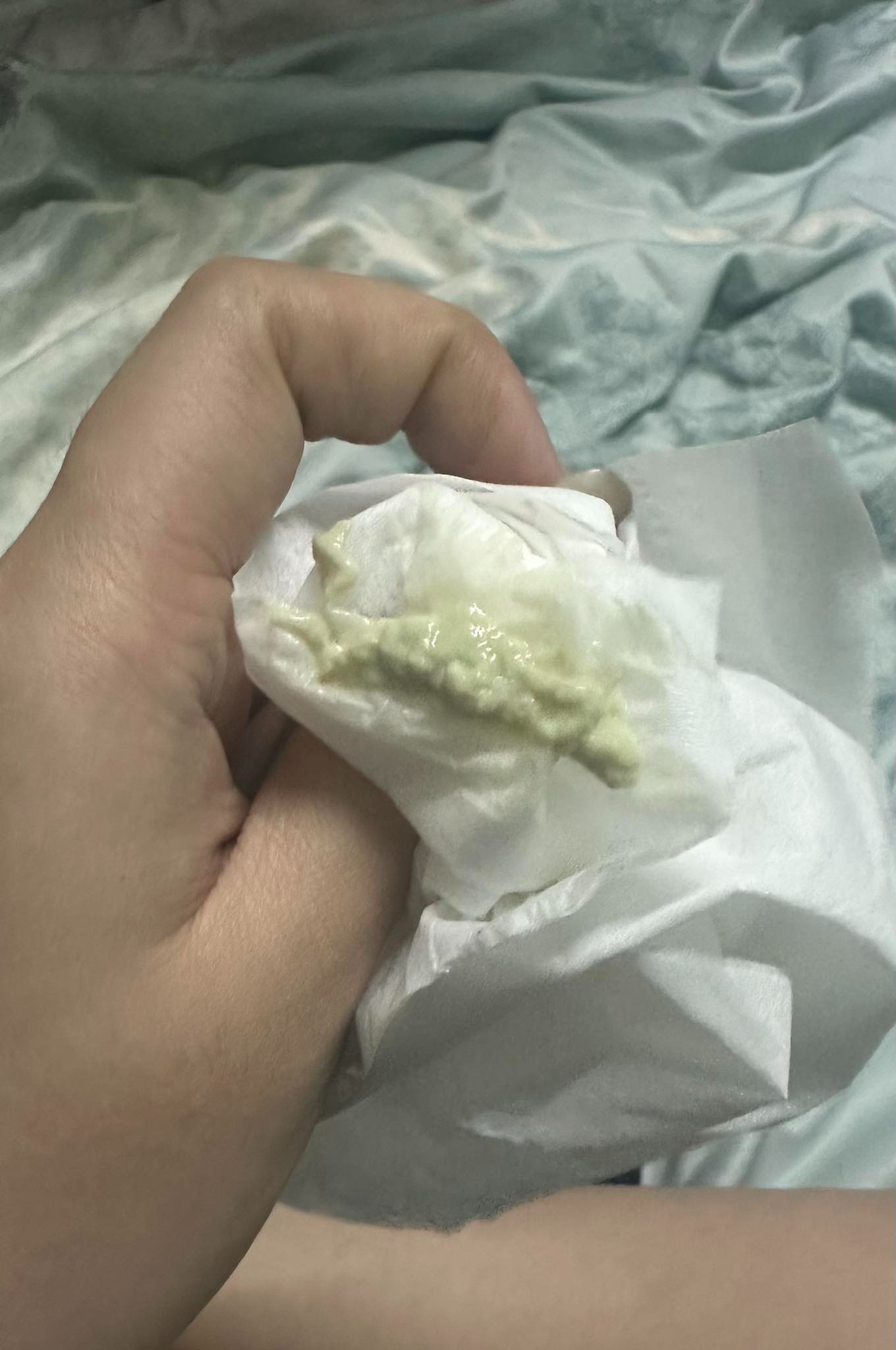 Khí hư đặc, vón cục trắng ngà là dấu hiệu gì? 2 Hình ảnh do khách hàng ẩn danh cung cấp