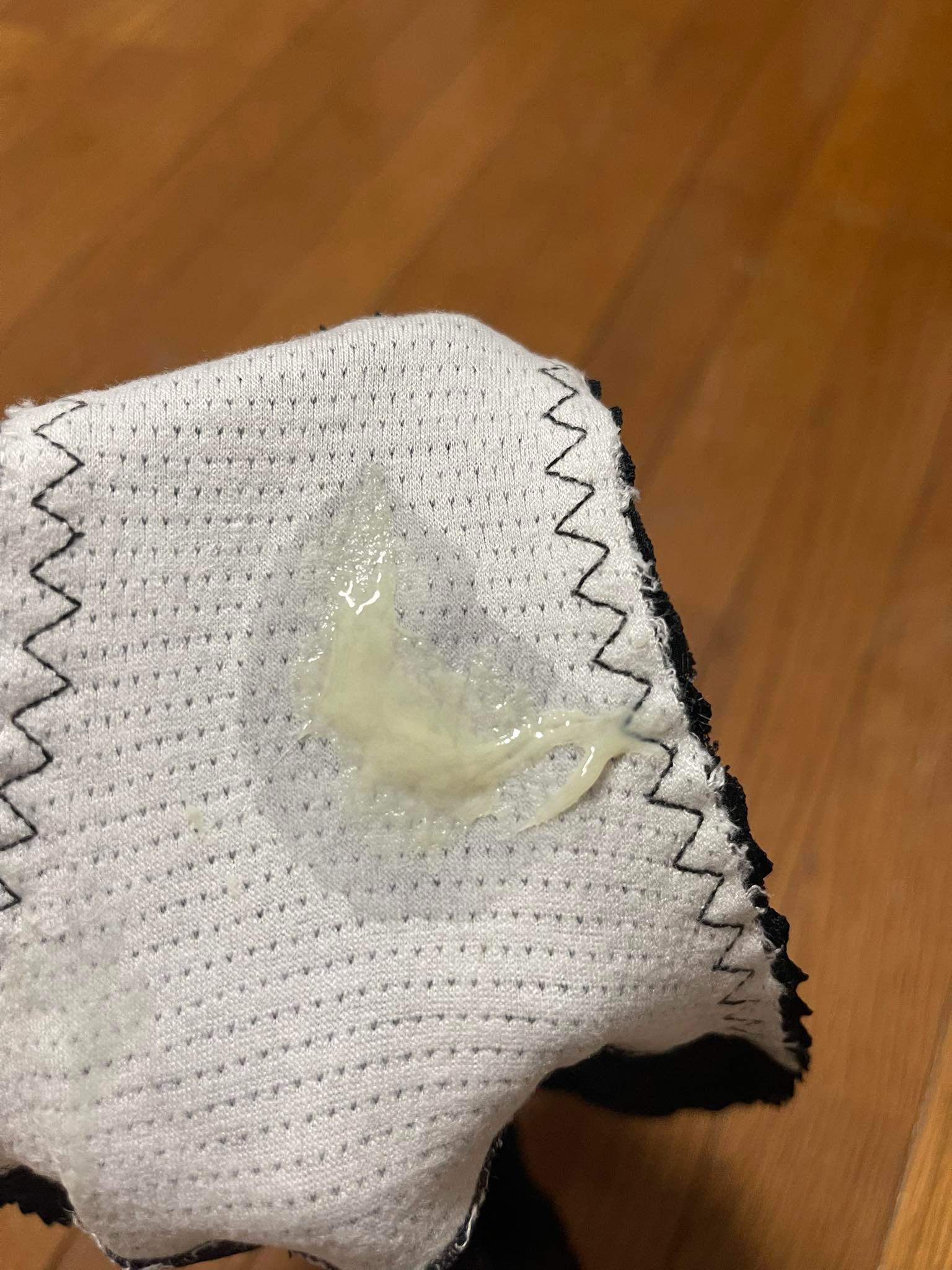 Ra dịch đục ngả vàng gần ngày rụng trứng có phải viêm không? 2 6913e22342d7f dich duc