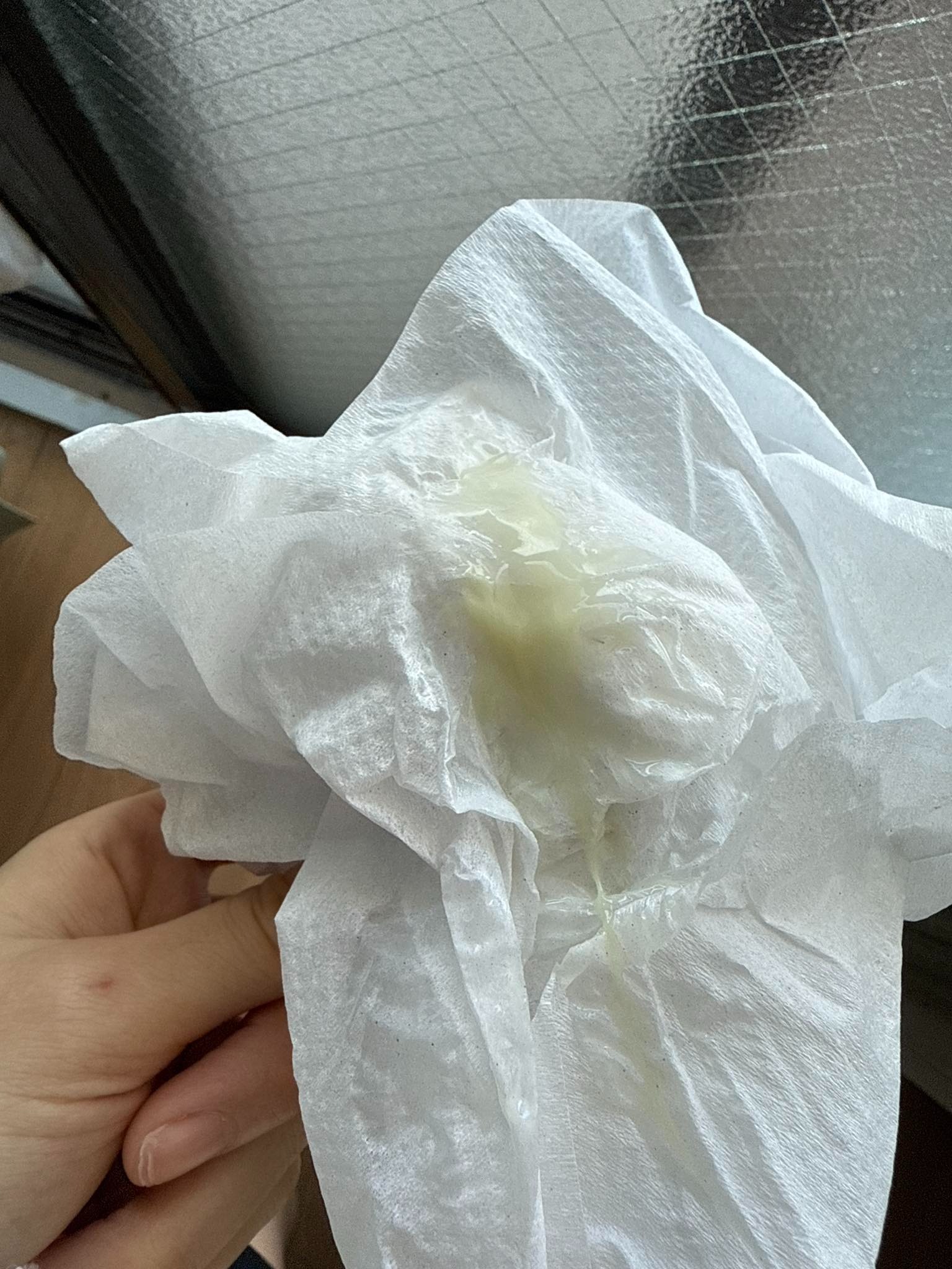 Ra nhiều khí hư bất thường như trong ảnh có phải bị viêm âm đạo không? 2 691be4d9d3dc2 khi hu nhieu