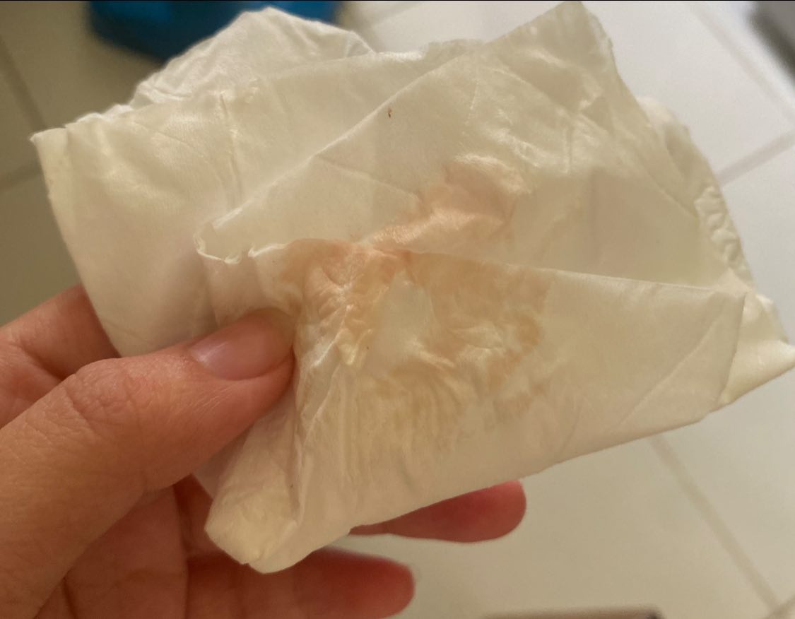 Quan hệ xong ra nhiều dịch màu đỏ nhạt, không đau rát là bị sao? 2 6940bb939f353 khi hu