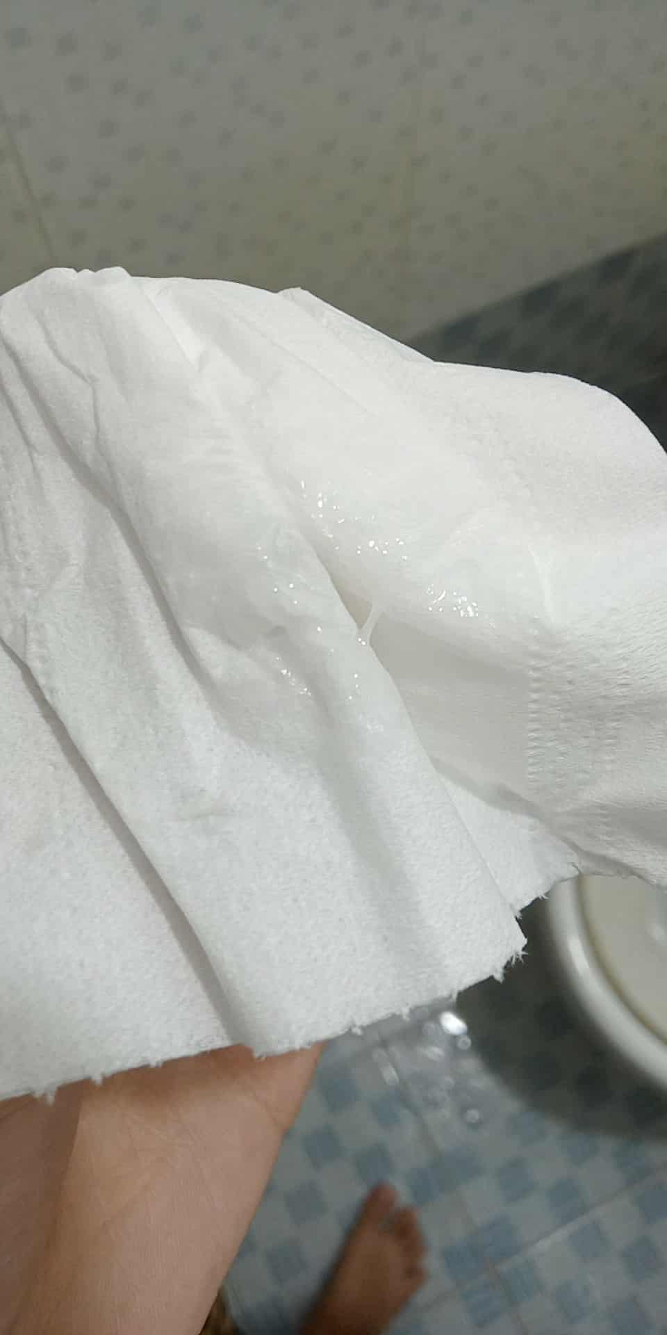 Làm thế nào khi ra dịch trắng trong, không ngứa? 2 561833575 848332727762012 7985637590979904616 n