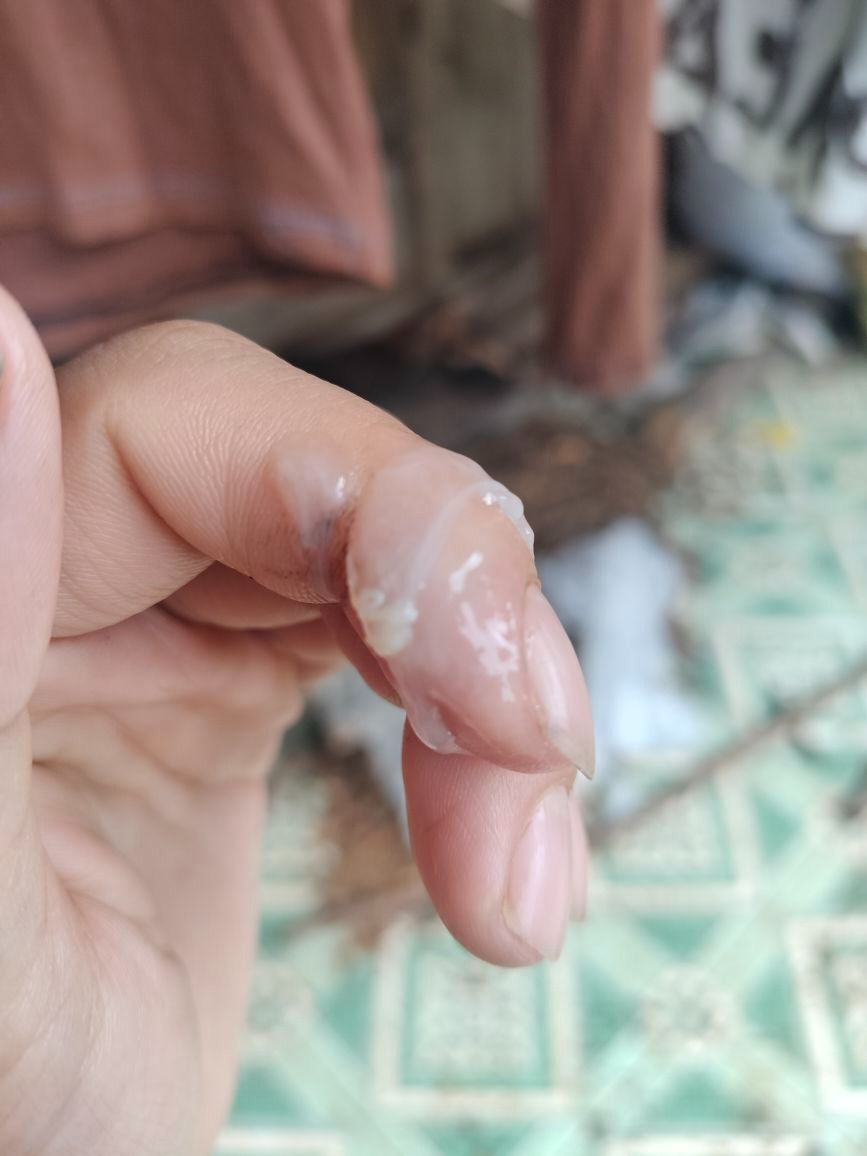 69457e8cba821 khi hu