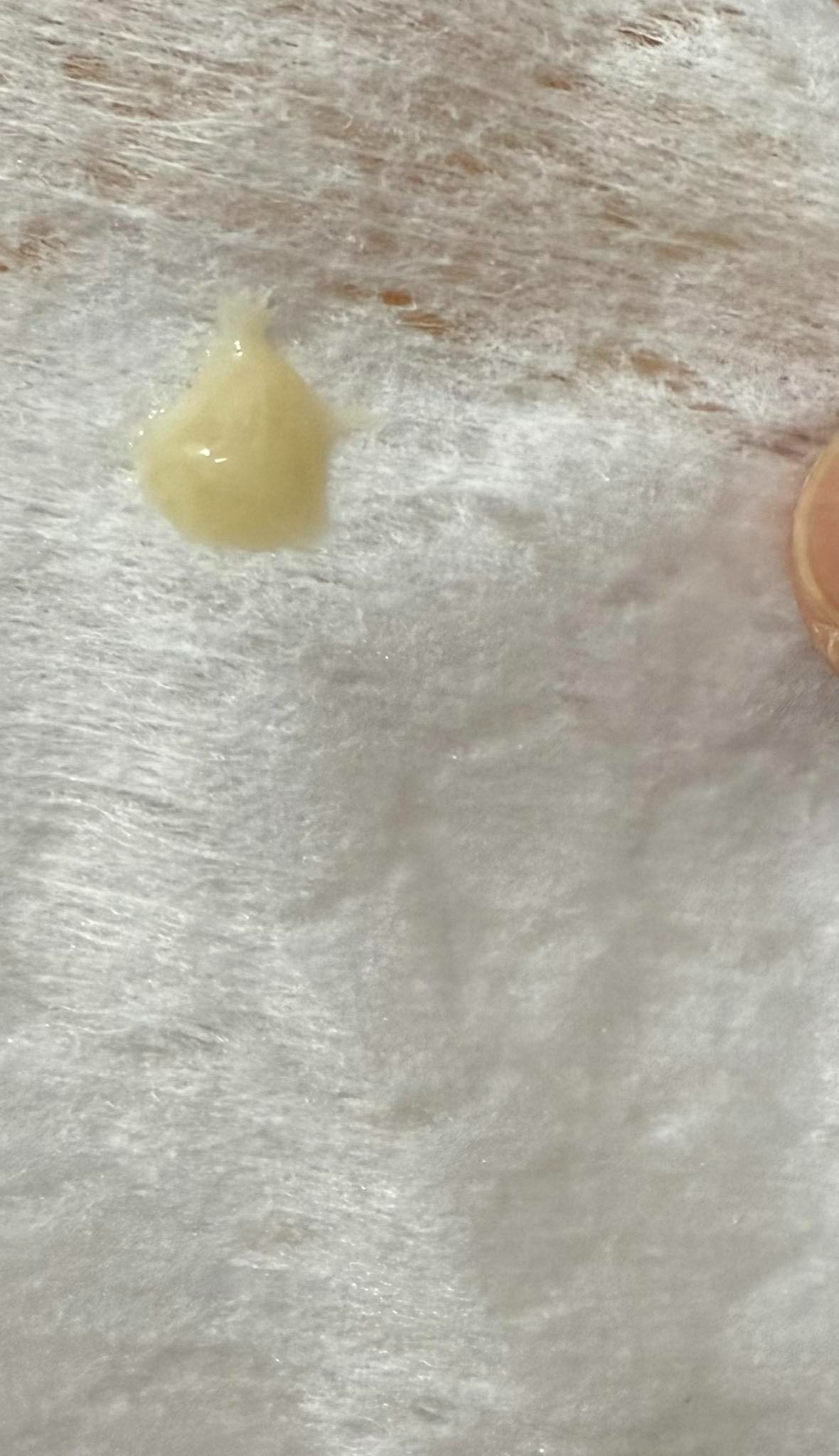 Sau sinh 2 tháng ra dịch âm đạo như vậy là bị gì? Có đáng lo không? 2 69467e70ed067 khi hu